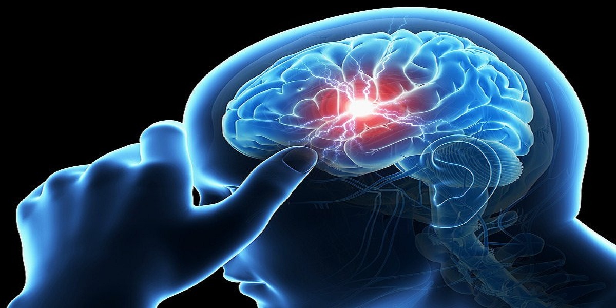 پیش‌بینی فرکانس بهینه‌ تحریک الکتریکی فراجمجمه‌ای در درمان تومور مغزی 